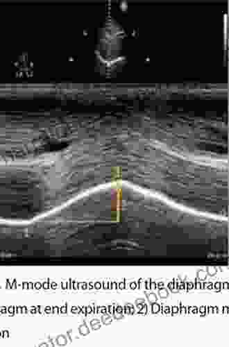 Ultrasound Of The Diaphragm And The Respiratory Muscles
